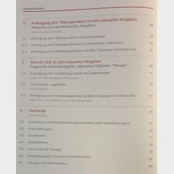 Das Stark Reduzierte Restgebiss